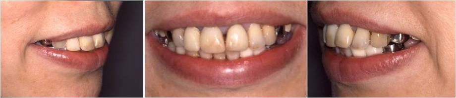 矯正歯科の症例